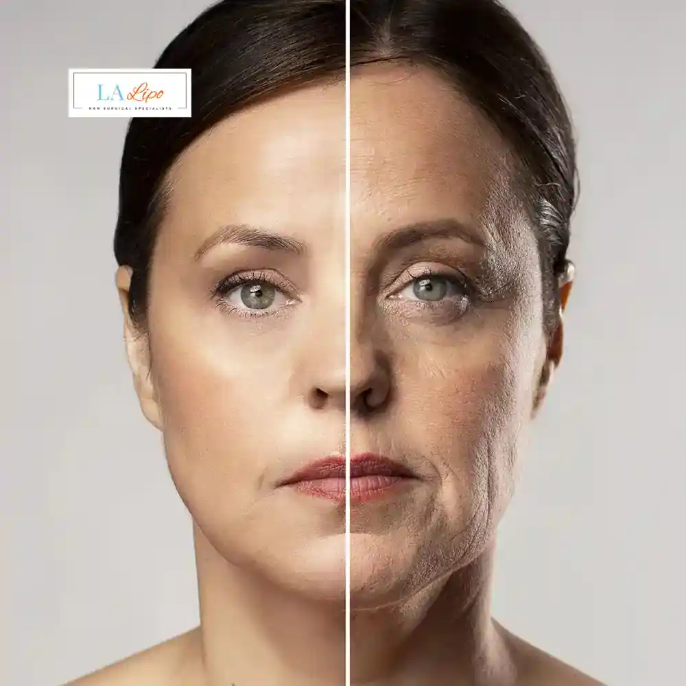How Can You Tell If Non-Surgical Skin Tightening Is Right for You Willesden?